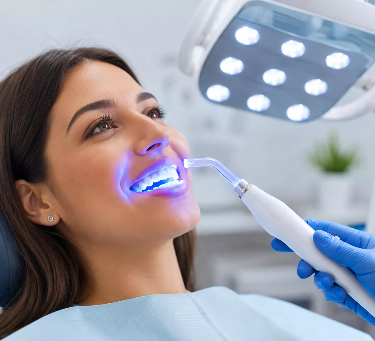 white-teethning